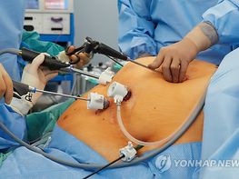 "뚱보 아저씨, 과격한 운동엔 무릎 조심하세요" 기사 이미지